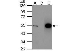 IP Image Immunoprecipitation of p53 protein.