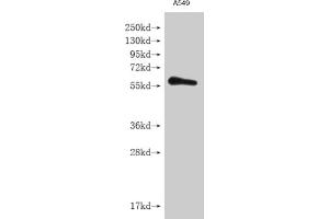 Western blot All lanes: IFNLR1 antibody at 3. (IL28RA anticorps  (AA 21-228))