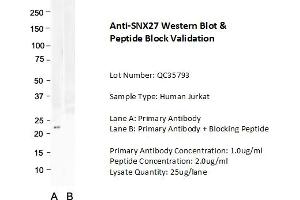 Host: Rabbit Target Name: SNX27 Sample Type: Human Jurkat  Lane A: Primary Antibody  Lane B: Primary Antibody + Blocking Peptide  Primary Antibody Concentration: 1. (SNX27 anticorps  (C-Term))