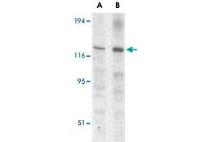 Western blot analysis of Casp12 (small) in mouse (lane A) and rat (lane B) liver lysate with Casp12 small polyclonal antibody  at 1 ug/mL . (Caspase 12 anticorps)