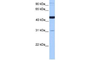 WB Suggested Anti-SCCPDH Antibody Titration: 0.