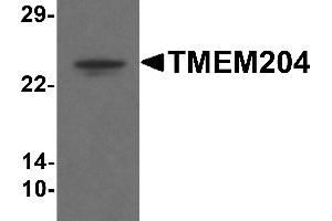 Western blot analysis of TMEM204 in human brain tissue lysate with TMEM204 antibody at 1 µg/mL . (TMEM204 anticorps  (C-Term))