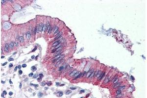 Human Colon (formalin-fixed, paraffin-embedded) stained with TJP3 antibody ABIN364296 at 10 ug/ml followed by biotinylated goat anti-rabbit IgG secondary antibody ABIN481713, alkaline phosphatase-streptavidin and chromogen. (TJP3 anticorps  (C-Term))