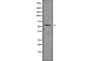 Western blot analysis of TRalpha using SKOV3 whole cell lysates (THRA anticorps  (N-Term))