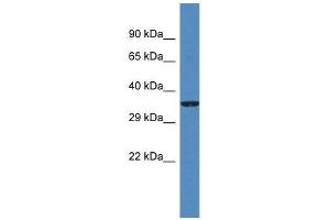 Western Blot showing Gm5581 antibody used at a concentration of 1. (Gm5581 anticorps  (N-Term))