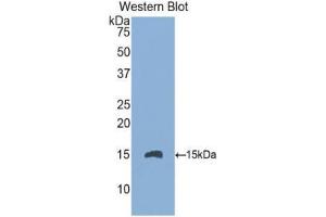 Western Blotting (WB) image for anti-Endoglin (ENG) (AA 336-450) antibody (ABIN1174025) (Endoglin anticorps  (AA 336-450))