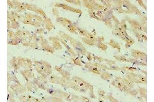 Immunohistochemistry of paraffin-embedded human heart tissue using ABIN7144868 at dilution of 1:100