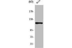 Western Blot analysis of HeLa cells using HXK I Polyclonal Antibody