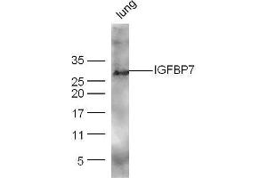 Mouse lung lysates probed with Rabbit Anti-IGFBP7 Polyclonal Antibody, Unconjugated  at 1:500 for 90 min at 37˚C. (IGFBP7 anticorps  (AA 131-230))