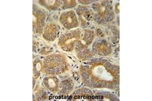 Immunohistochemistry (IHC) image for anti-Cellular Retinoic Acid Binding Protein 1 (CRABP1) antibody (ABIN3002339)