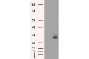 Western Blotting (WB) image for anti-Serine Racemase (SRR) antibody (ABIN1501137) (SRR anticorps)