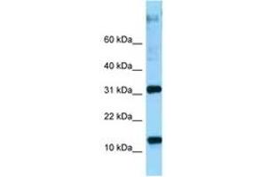 Image no. 1 for anti-Ribosomal Protein L22 (RPL22) (AA 73-122) antibody (ABIN6748251) (RPL22 anticorps  (AA 73-122))