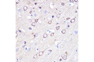 Immunohistochemistry of paraffin-embedded rat brain using Stathmin 1 Rabbit pAb (ABIN3023126, ABIN3023127, ABIN3023128 and ABIN6219402) at dilution of 1:100 (40x lens).