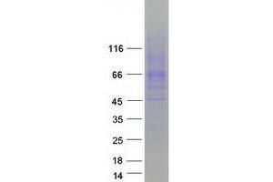 Validation with Western Blot