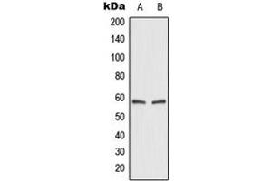 Western blot analysis of GLUT2 expression in HEK293T (A), rat kidney (B) whole cell lysates.