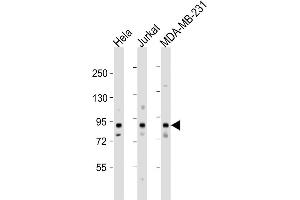 Western Blot at 1:1000 dilution Lane 1: Hela whole cell lysate Lane 2: Jurkat whole cell lysate Lane 3: MDA-MB-231 whole cell lysate Lysates/proteins at 20 ug per lane. (MYSM1 anticorps  (N-Term))