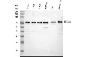Western blot analysis of BDKRB2 using anti-BDKRB2 antibody (ABIN3043340).