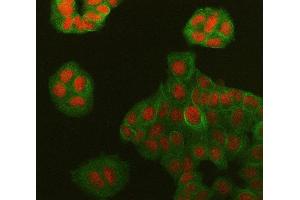 IF analysis of Symplekin/SYMPK using anti-Symplekin/SYMPK antibody (ABIN7601558) and anti-Tubulin Alpha antibody (ABIN7600339). (Symplekin anticorps  (AA 384-1092))