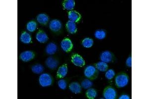IF analysis of FXI/F11 using anti-FXI/F11 antibody (ABIN7602456).