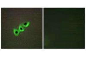 Immunofluorescence analysis of A549 cells, using RHG07 antibody. (DLC1 anticorps)