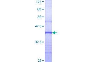 Image no. 1 for Glucosidase, Alpha, Acid (GAA) (AA 851-952) protein (GST tag) (ABIN1354617)