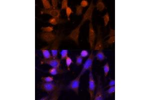 Immunofluorescence analysis of NIH-3T3 cells using VPS26A Polyclonal Antibody  at dilution of 1:100 (40x lens).