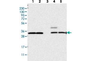 Western blot analysis of Lane 1: RT-4, Lane 2: U-251 MG, Lane 3: Human Plasma, Lane 4: Liver, Lane 5: Tonsil with UBE3D polyclonal antibody  at 1:250-1:500 dilution. (UBE3D anticorps)