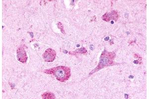 Anti-LPHN3 antibody  ABIN1049027 IHC staining of human brain, neurons. (LPHN3 anticorps  (C-Term))