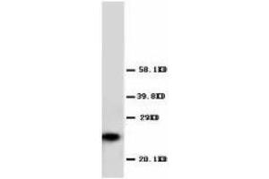 Image no. 1 for anti-Glutathione S-Transferase pi 1 (GSTP1) (AA 197-210) antibody (ABIN1493408)