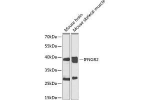 Western blot analysis of extracts of various cell lines, using IFNGR2 antibody (ABIN6134792, ABIN6142200, ABIN6142202 and ABIN6223464) at 1:1000 dilution. (IFNGR2 anticorps  (C-Term))