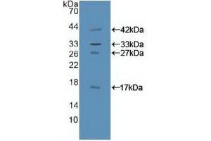 Detection of Recombinant GAB1, Human using Polyclonal Antibody to GRB2 Associated Binding Protein 1 (GAB1) (GAB1 anticorps  (AA 394-656))
