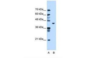 Image no. 2 for anti-Phosphoglycerate Kinase 1 (PGK1) (AA 301-350) antibody (ABIN321382) (PGK1 anticorps  (AA 301-350))
