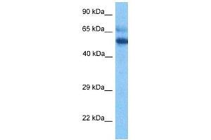 Host:  Rabbit  Target Name:  ESCO2  Sample Tissue:  Thymus Tumor lysates  Antibody Dilution:  1ug/ml (ESCO2 anticorps  (Middle Region))