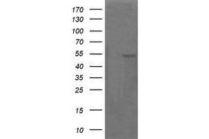 Image no. 2 for anti-Parvin, alpha (PARVA) antibody (ABIN1496445) (Parvin alpha anticorps)
