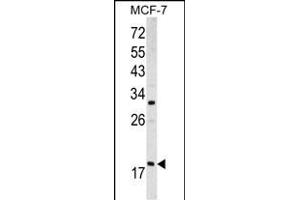 Western blot analysis of ARF3 antibody (Center D93) (ABIN390530 and ABIN2840877) in MCF-7 cell line lysates (35 μg/lane). (ARF3 anticorps  (AA 78-106))