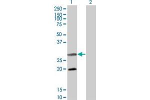 Western Blot analysis of DIABLO expression in transfected 293T cell line by DIABLO monoclonal antibody (M02), clone 4F9. (DIABLO anticorps  (AA 119-218))