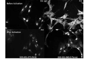 Anti NFkB monoclonal antibody – Immunocytochemistry Tissue: Human Fibroblasts Top: Before activation Bottom: After activation with poly IC Left: 600-401-271 anti p65 NLS specific lot 18372 Right:  Monoclonal antibody C-Term The two antibodies that are shown target different regions of the p65 protein.