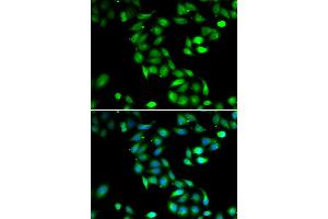 Immunofluorescence analysis of HeLa cell using PDCD6 antibody. (PDCD6 anticorps)