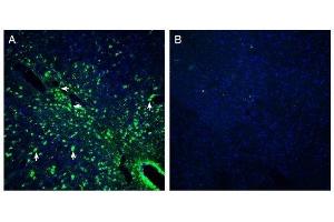 Expression of Presenilin-2 in mouse midbrainImmunohistochemical staining of perfusion-fixed frozen mouse brain sections with Anti-Presenilin-2 Antibody (ABIN7043554, ABIN7044526 and ABIN7044527), (1:200), followed by goat anti-rabbit-AlexaFluor-488.