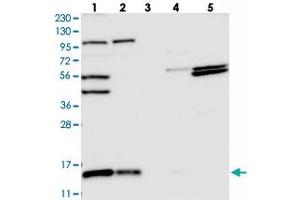 Western blot analysis of Lane 1: RT-4, Lane 2: U-251 MG, Lane 3: Human Plasma, Lane 4: Liver, Lane 5: Tonsil with FAM136A polyclonal antibody  at 1:250-1:500 dilution. (FAM136A anticorps)