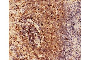 IHC-P testing of rat spleen tissue