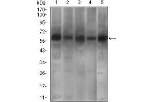 Western Blotting (WB) image for anti-phosphodiesterase 1B, Calmodulin-Dependent (PDE1B) (AA 370-536) antibody (ABIN1845413)