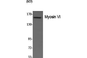 Western Blotting (WB) image for anti-Myosin VI (MYO6) antibody (ABIN5958676) (Myosin VI anticorps)