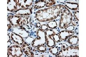 Immunohistochemistry (IHC) image for anti-Induced Myeloid Leukemia Cell Differentiation Protein Mcl-1 (MCL1) antibody (ABIN1499341)