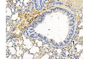 ABIN7096583 and ABIN7100647 at 1/100 staining mouse lung tissue by IHC-P. (RUFY3 anticorps)