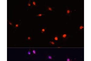 Immunofluorescence analysis of C6 cells using MCM5 Polyclonal Antibody at dilution of 1:100.
