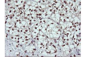 Image no. 3 for anti-Dynamin 1-Like (DNM1L) antibody (ABIN1497871)