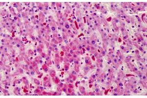 Human Liver: Formalin-Fixed, Paraffin-Embedded (FFPE) (STEAP4 anticorps  (AA 201-250))