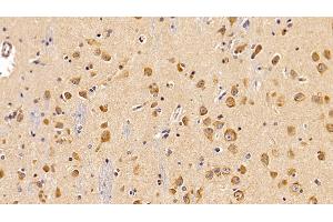 Detection of LEPR in Human Cerebrum Tissue using Polyclonal Antibody to Leptin Receptor (LEPR)