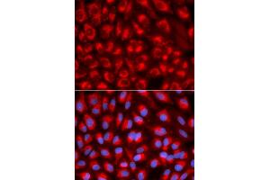 Immunofluorescence analysis of U2OS cells using TFAM antibody (ABIN5970991).